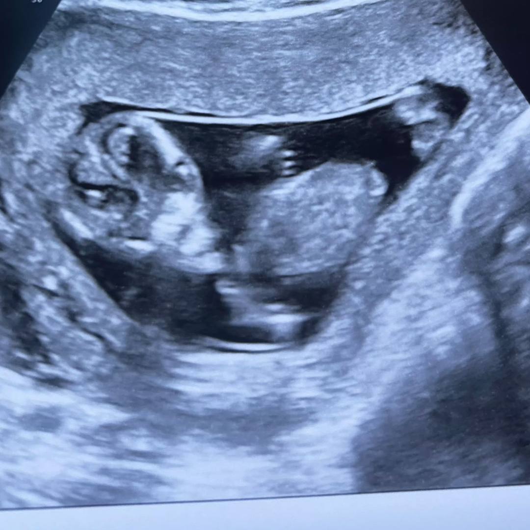 Photo shared by Amber for their Babylist baby registry.