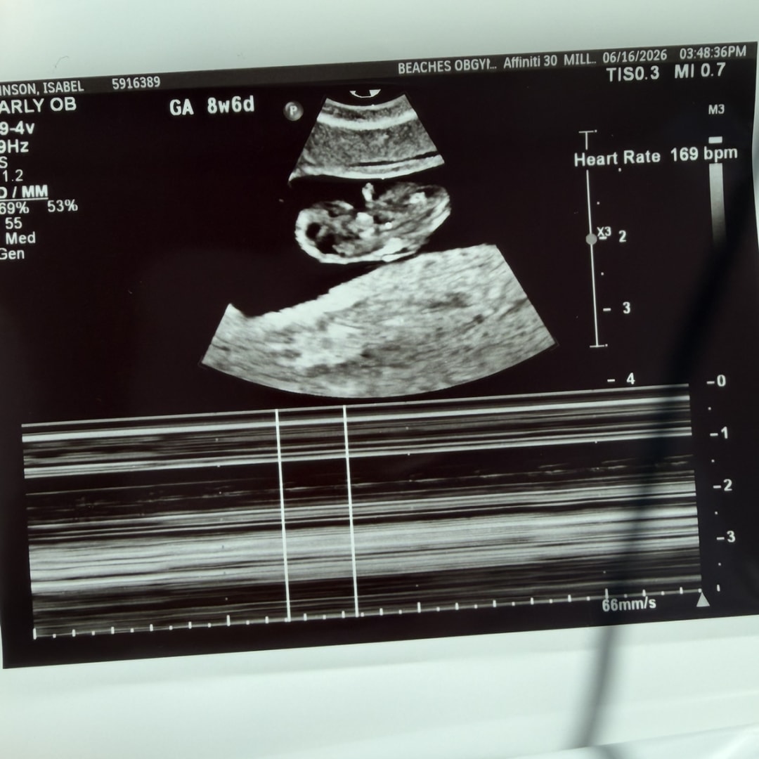 Photo shared by Isabel for their Babylist baby registry.