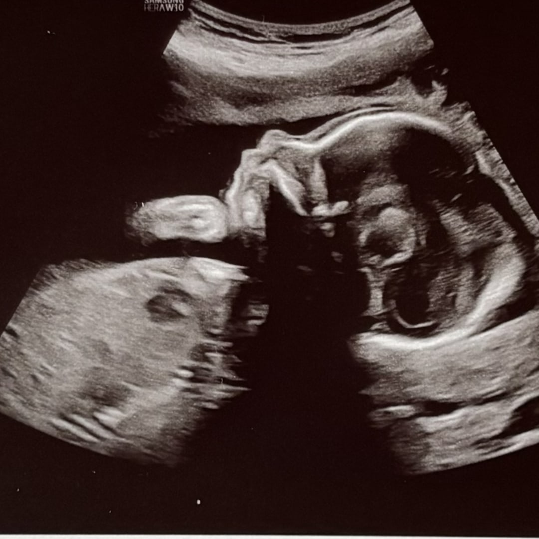 Photo shared by Chih-Ru for their Babylist baby registry.