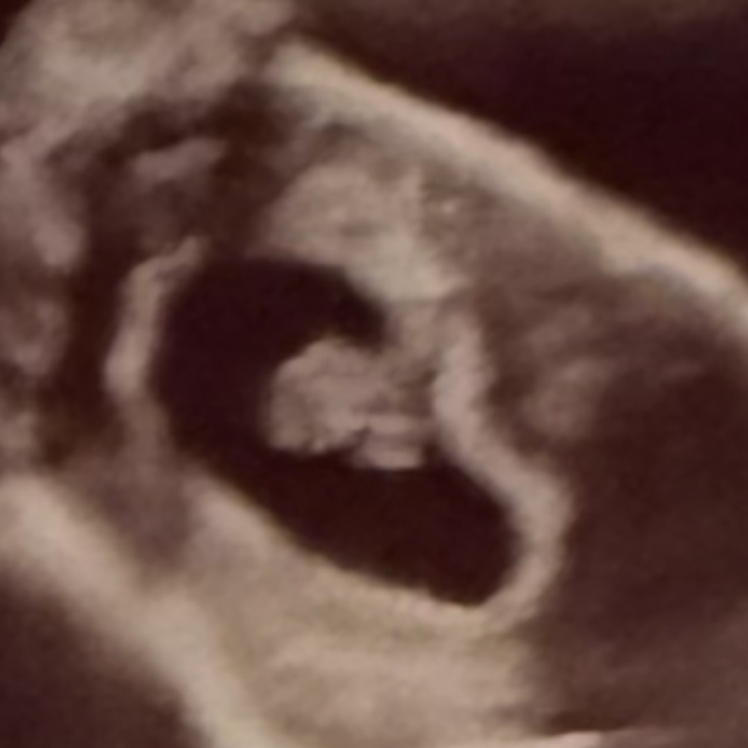 Photo shared by Claudia for their Babylist baby registry.