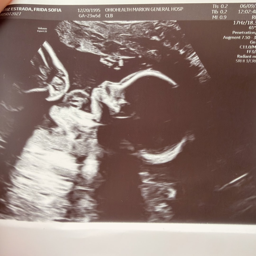 Photo shared by Frida for their Babylist baby registry.