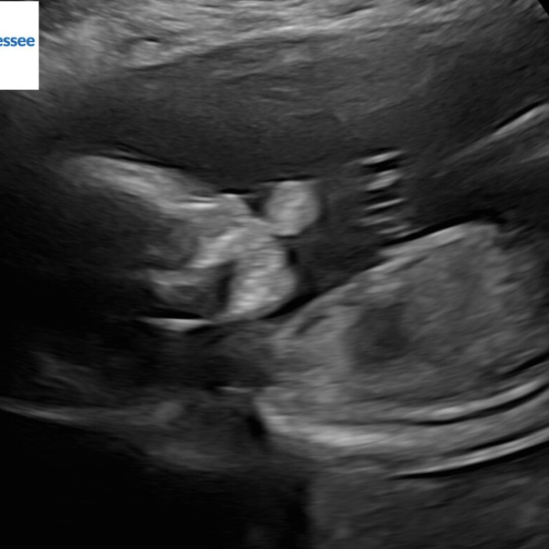 Photo shared by Lillie for their Babylist baby registry.