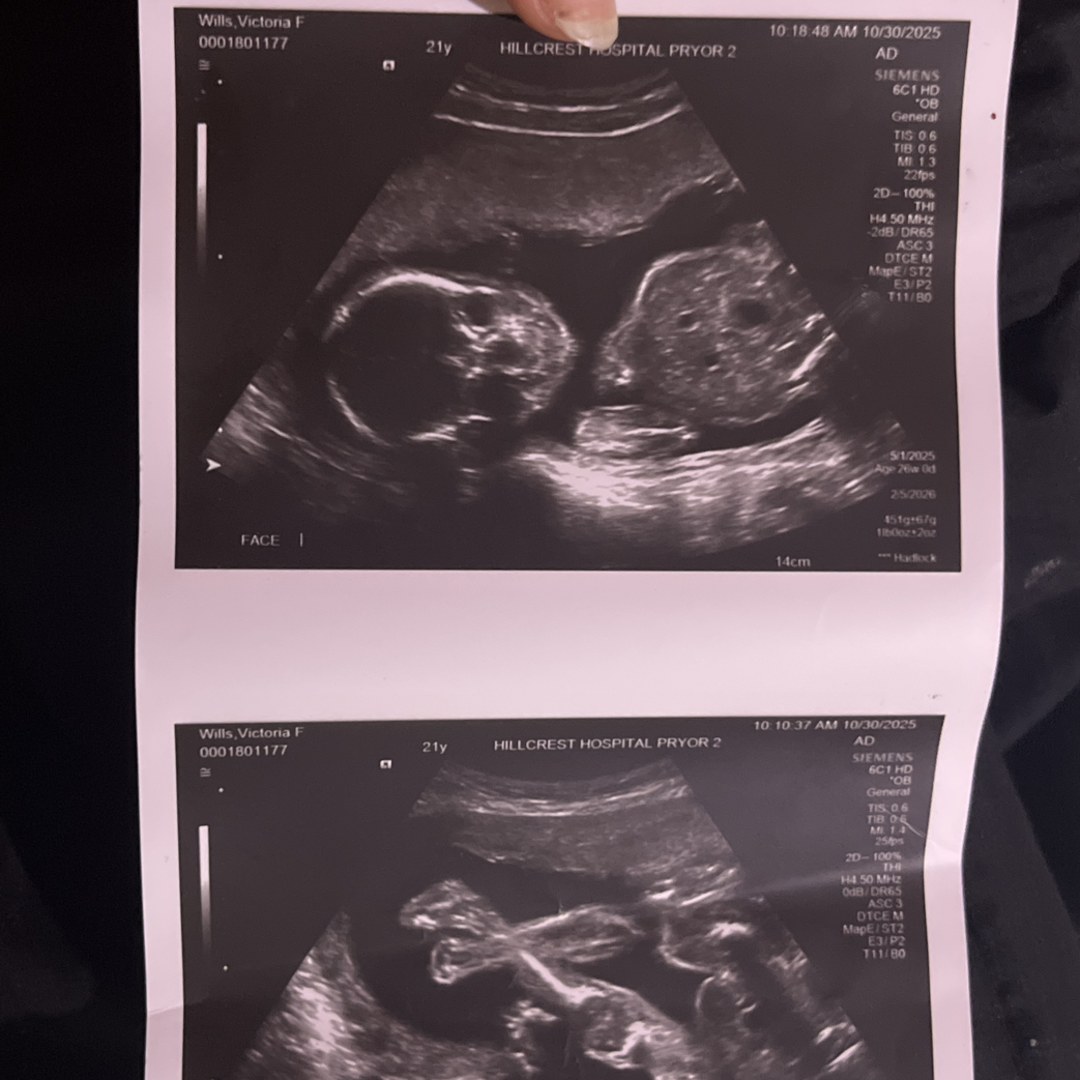 Photo shared by Vic for their Babylist baby registry.