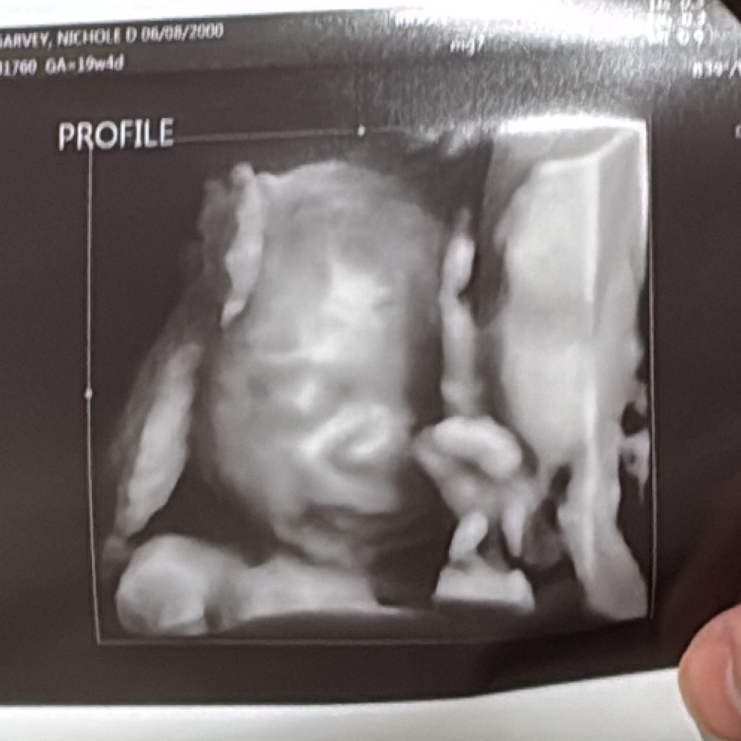 Photo shared by Nichole for their Babylist baby registry.