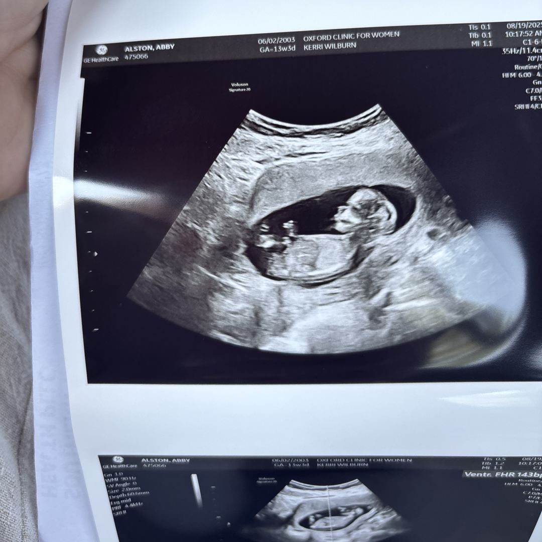Photo shared by Abby for their Babylist baby registry.