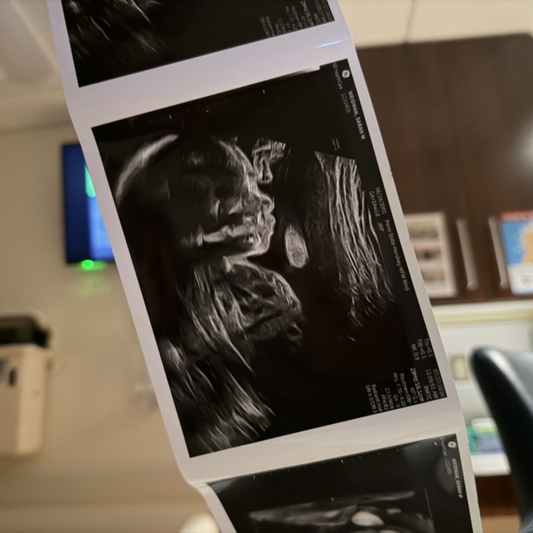 Photo shared by Sarah for their Babylist baby registry.