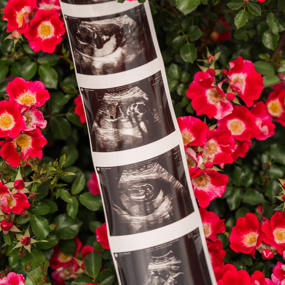 Photo shared by Marissa for their Babylist baby registry.