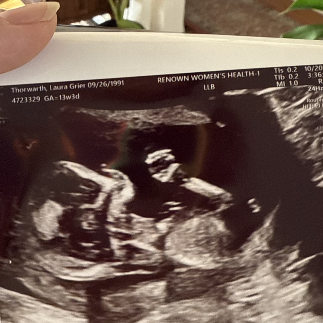 Photo shared by Laura for their Babylist baby registry.