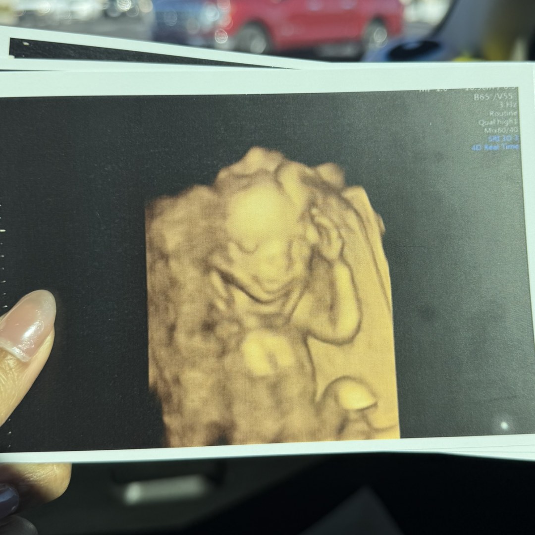 Photo shared by Mukda for their Babylist baby registry.