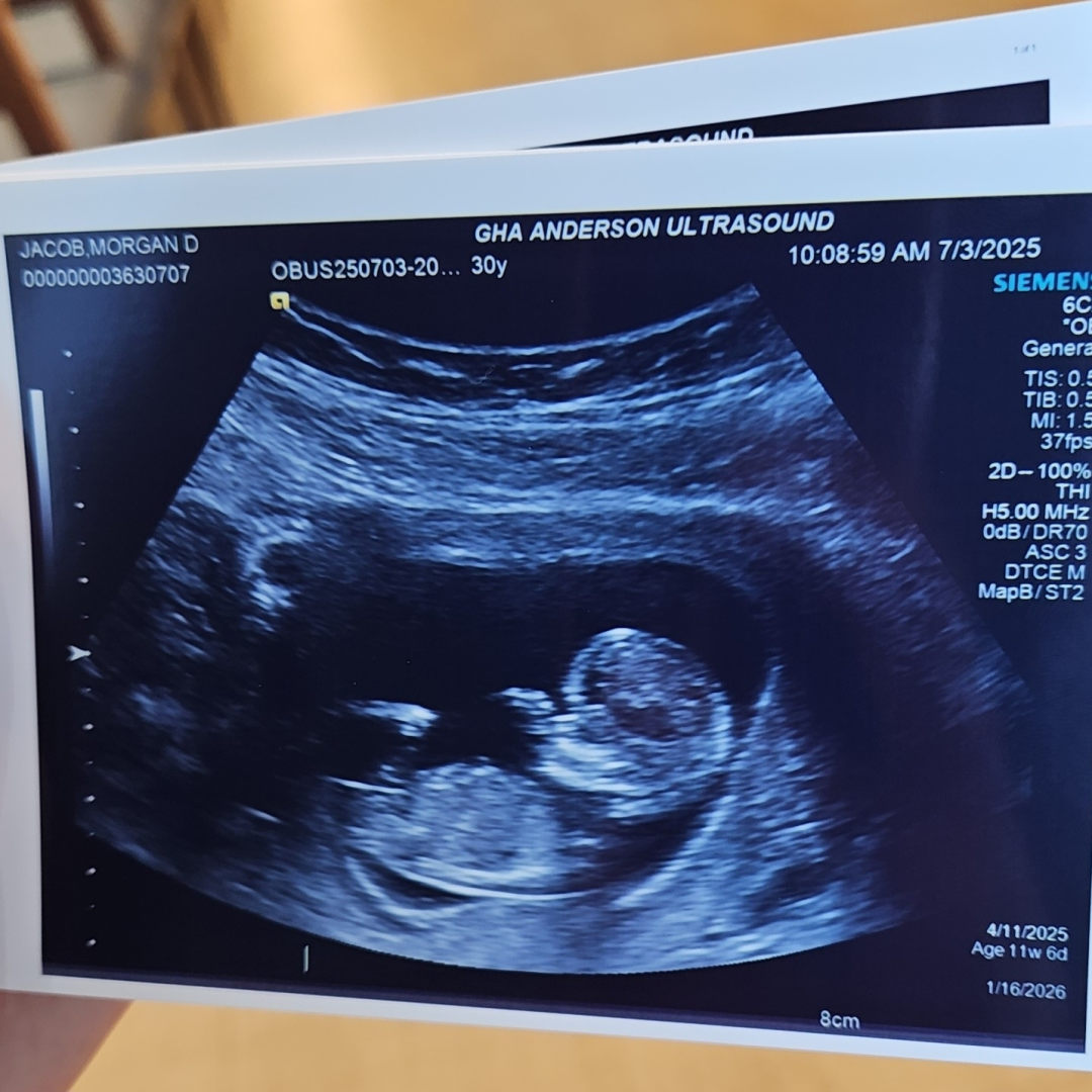 Photo shared by Morgan for their Babylist baby registry.