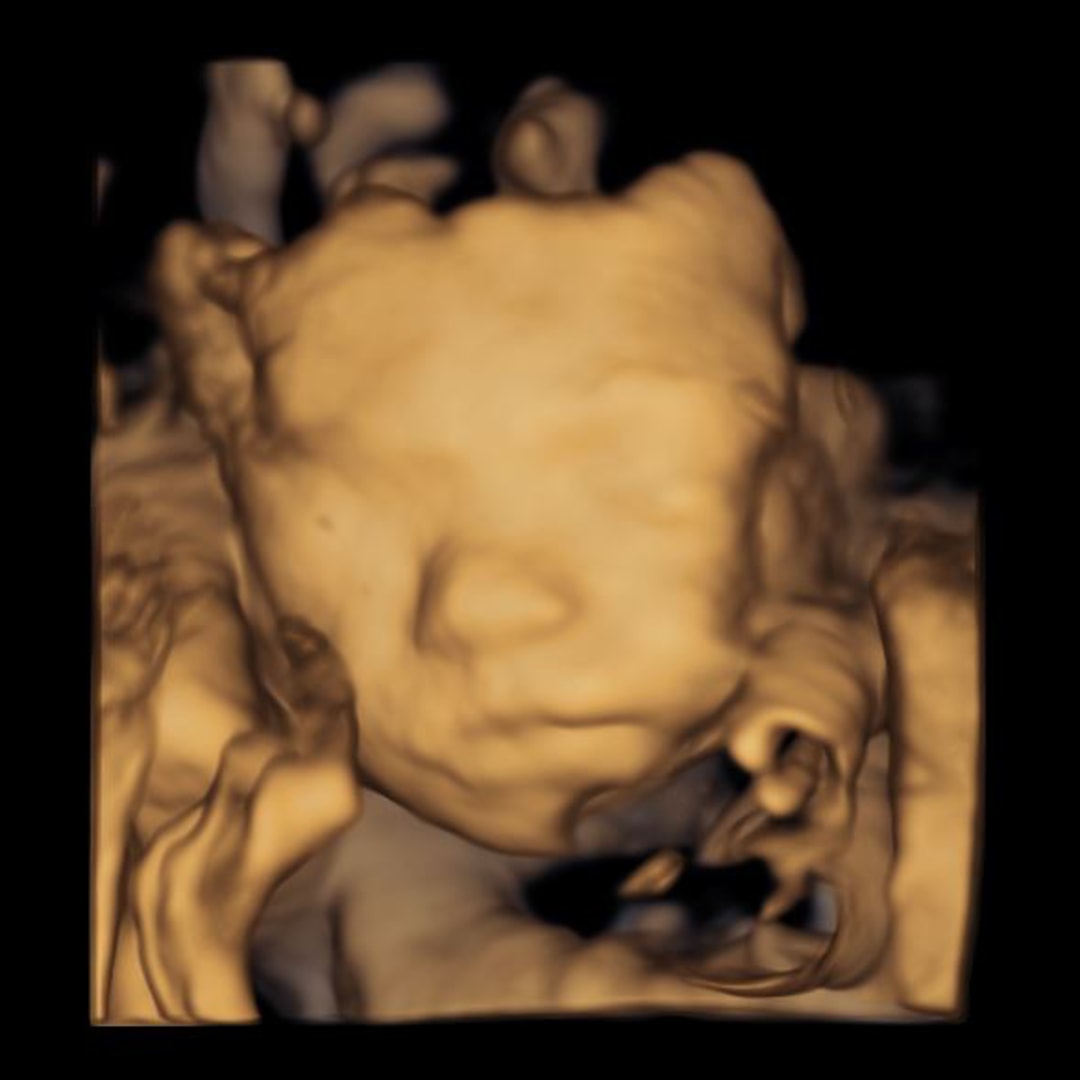 Photo shared by Kirsten for their Babylist baby registry.