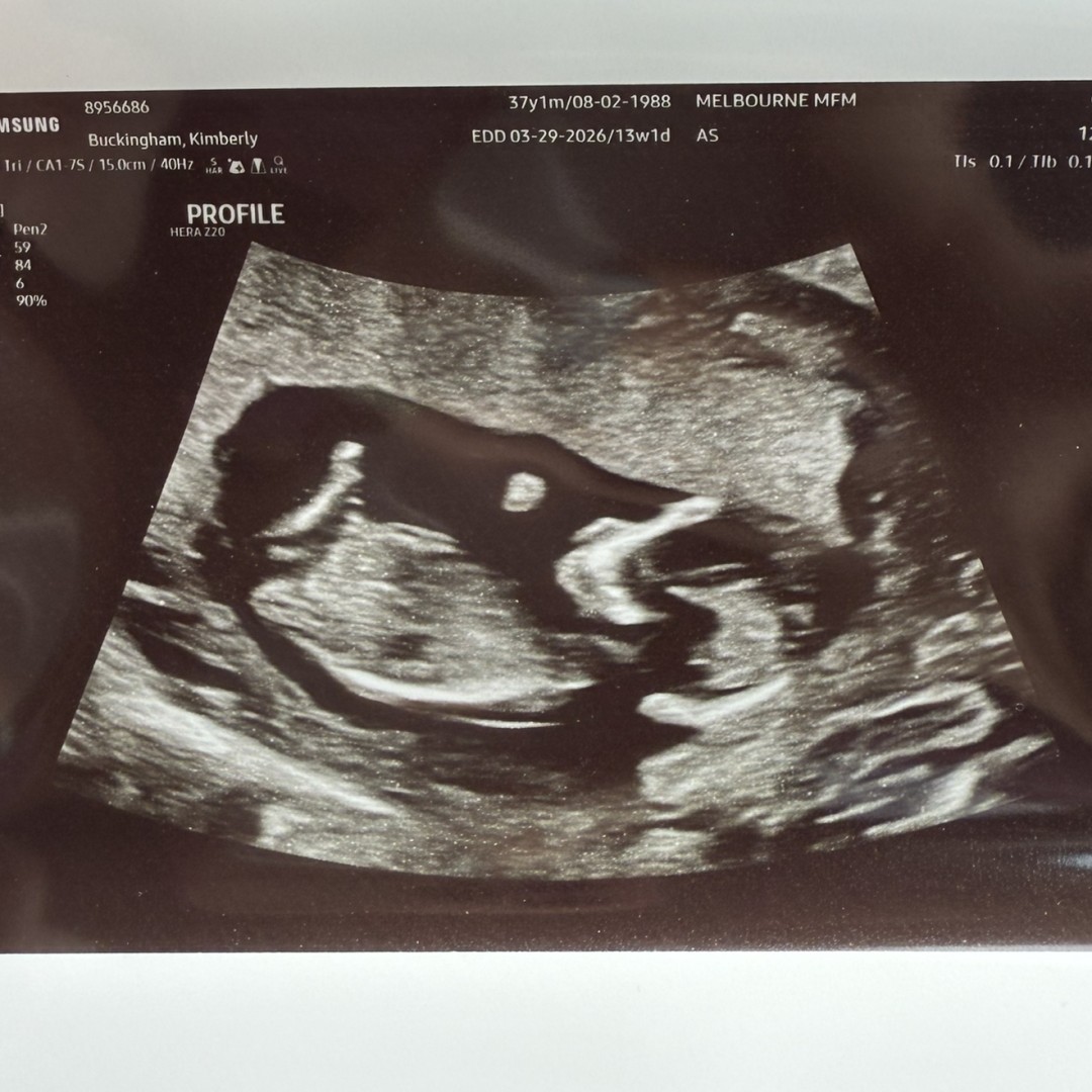 Photo shared by Kim for their Babylist baby registry.