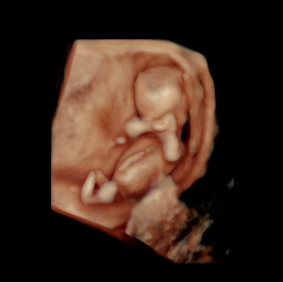 Photo shared by Megan for their Babylist baby registry.