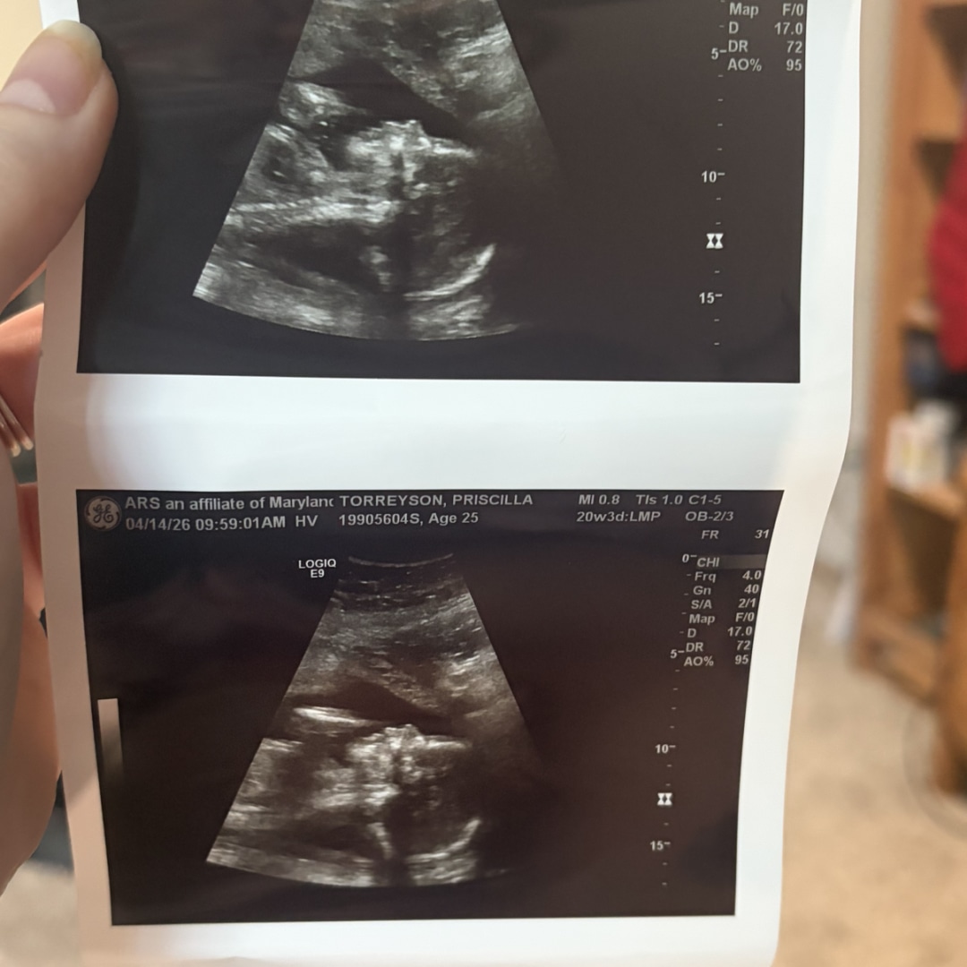 Photo shared by Priscilla for their Babylist baby registry.