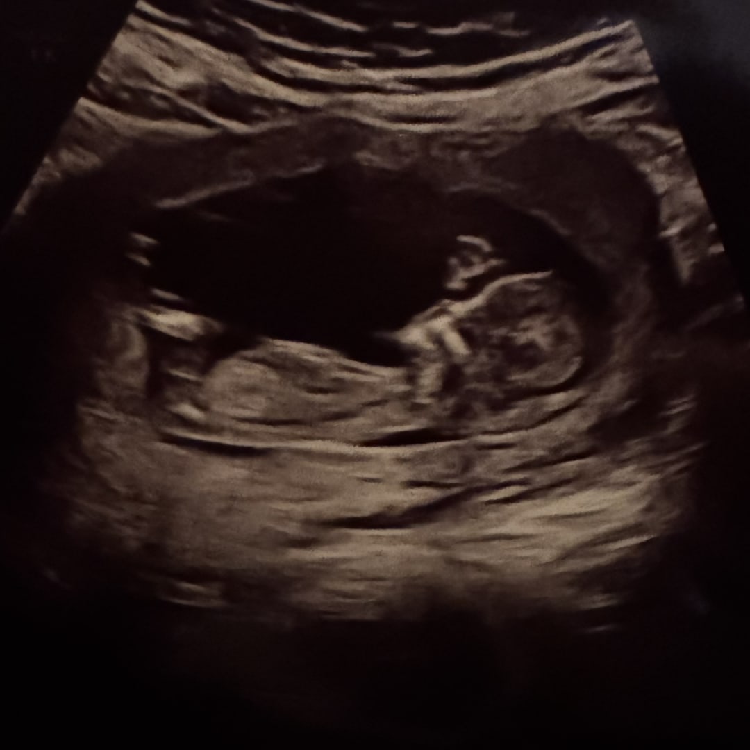 Photo shared by Vanessa for their Babylist baby registry.