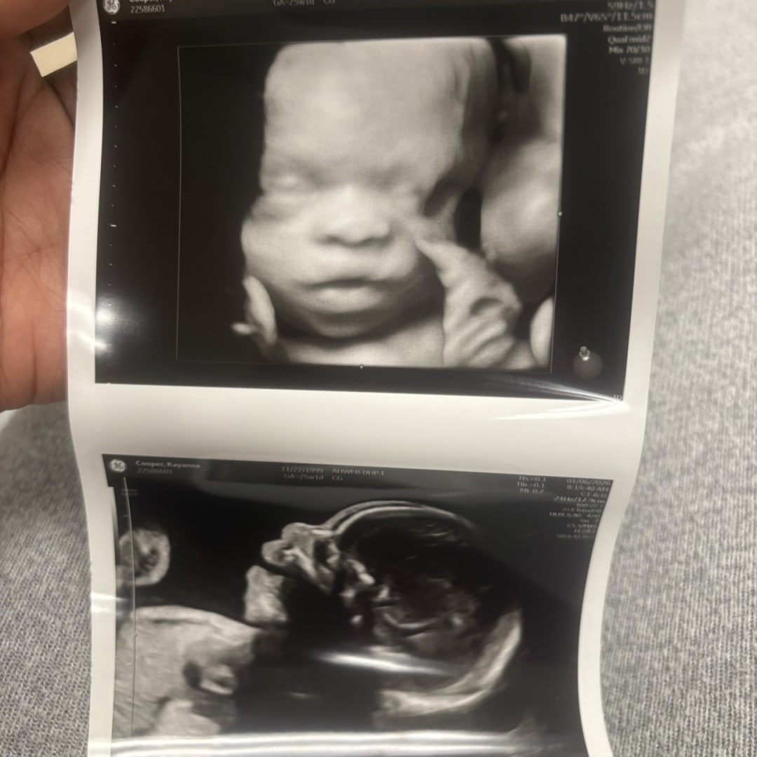 Photo shared by Kayanna for their Babylist baby registry.