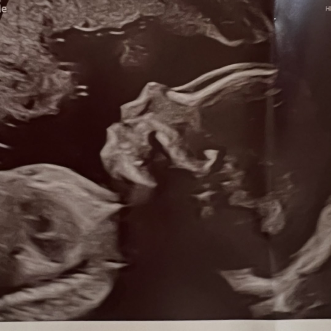 Photo shared by Annalisa for their Babylist baby registry.