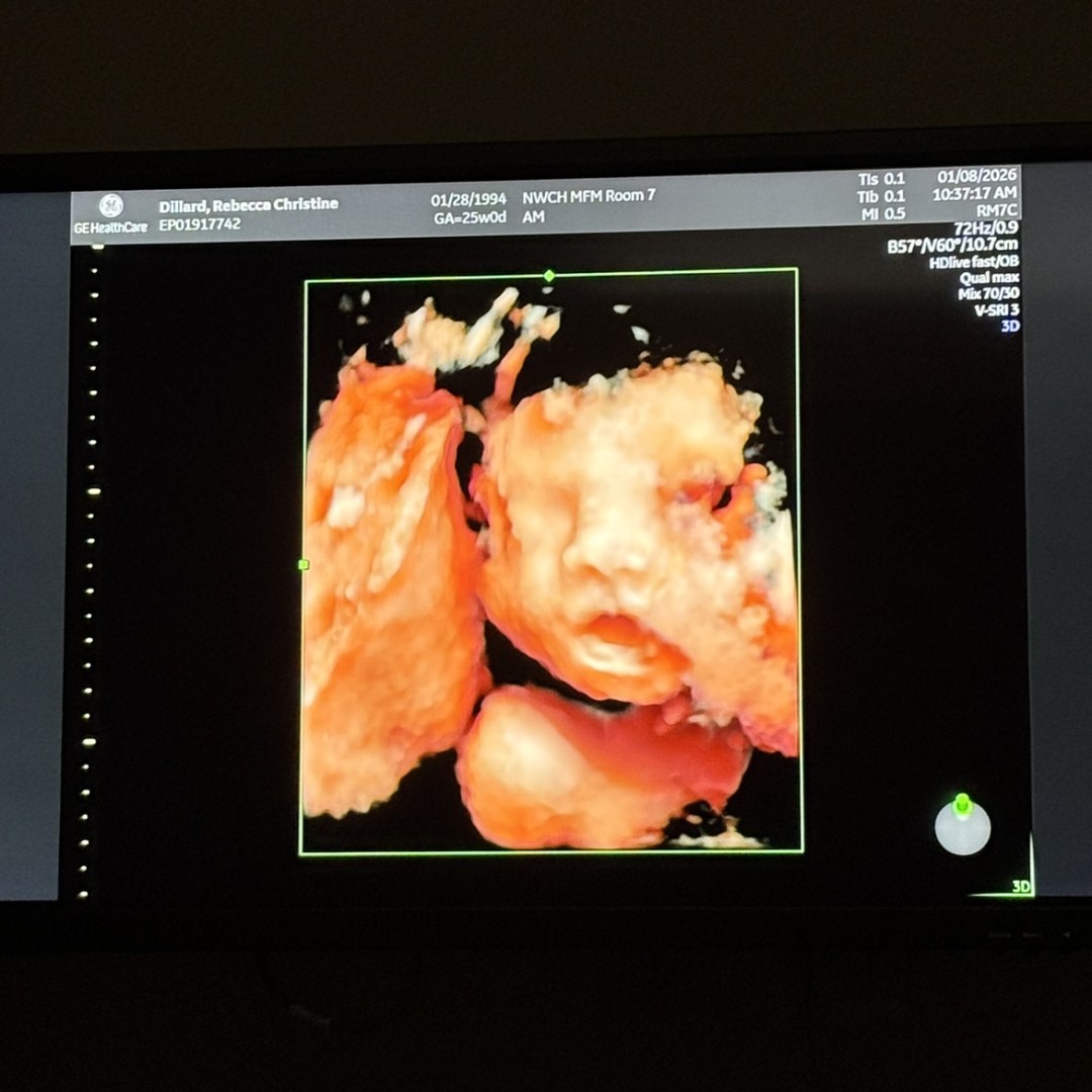 Photo shared by Becca for their Babylist baby registry.