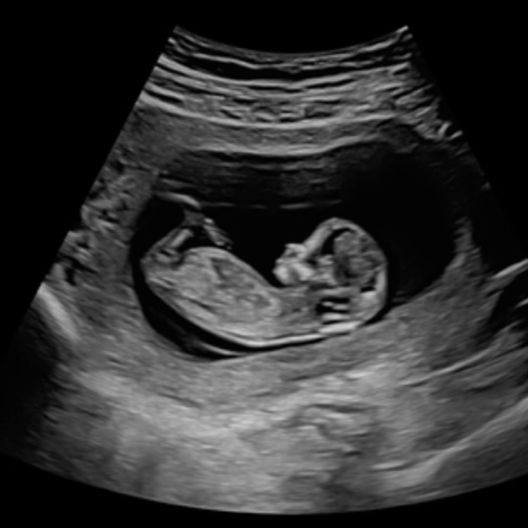 Photo shared by Bailey for their Babylist baby registry.