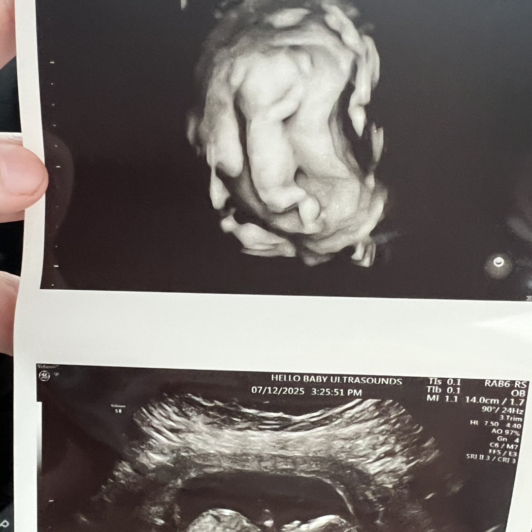 Photo shared by Alicia for their Babylist baby registry.