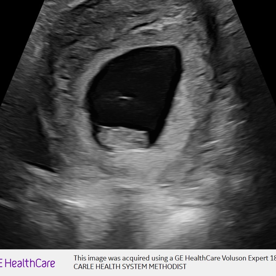 Photo shared by Amanda for their Babylist baby registry.