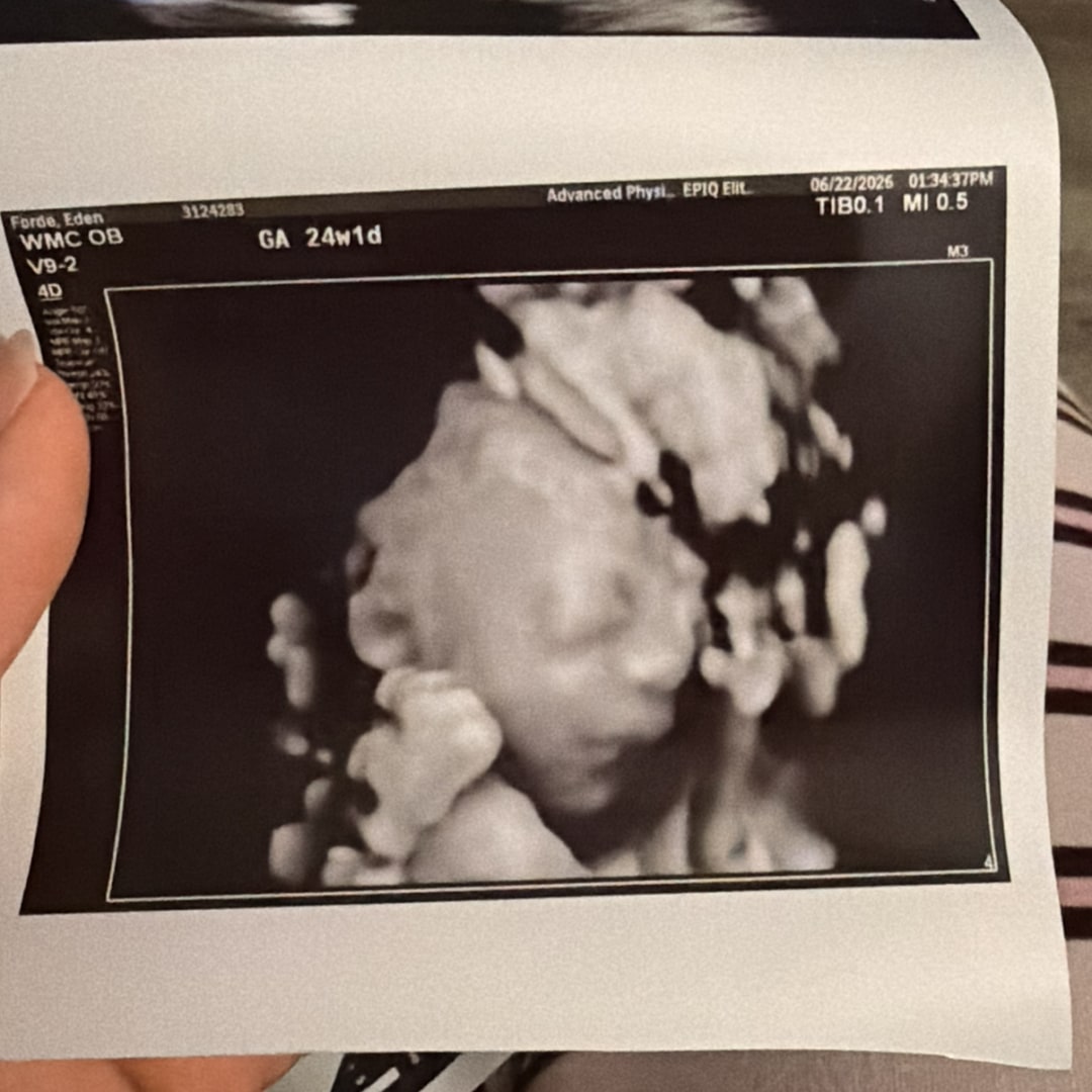 Photo shared by Eden for their Babylist baby registry.