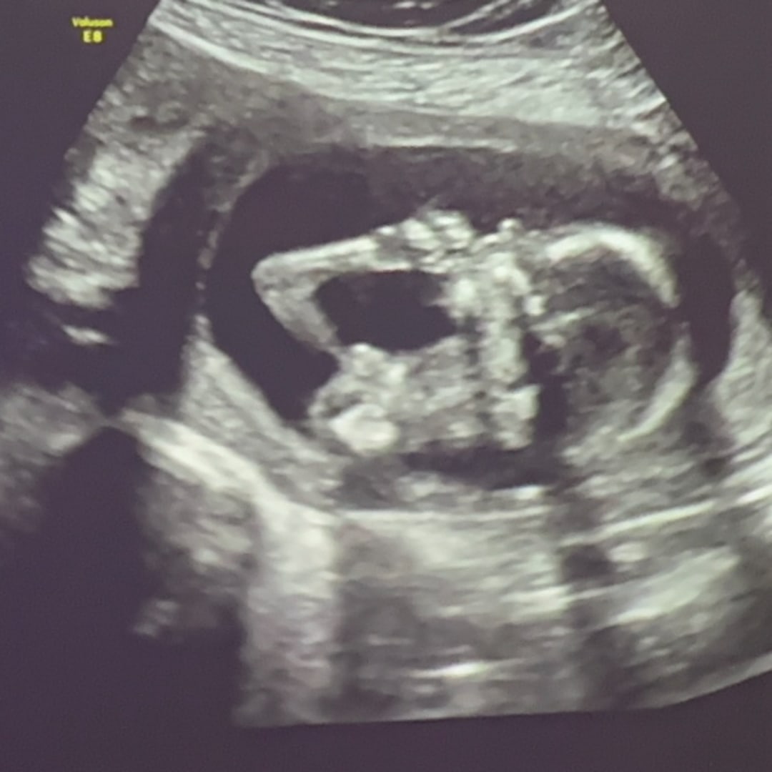 Photo shared by Michelle for their Babylist baby registry.