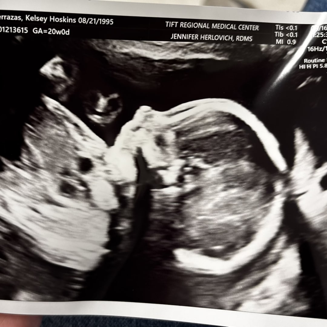 Photo shared by Kelsey for their Babylist baby registry.