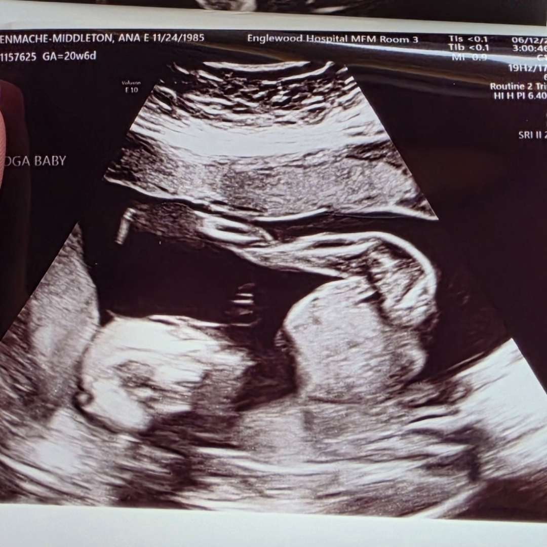 Photo shared by Elizabeth for their Babylist baby registry.