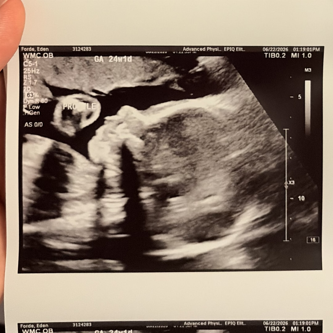 Photo shared by Eden for their Babylist baby registry.
