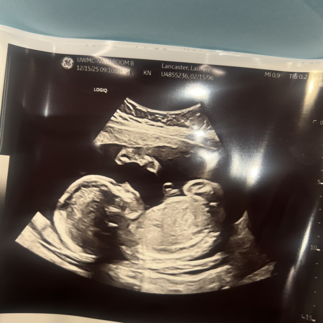 Photo shared by Lauren for their Babylist baby registry.