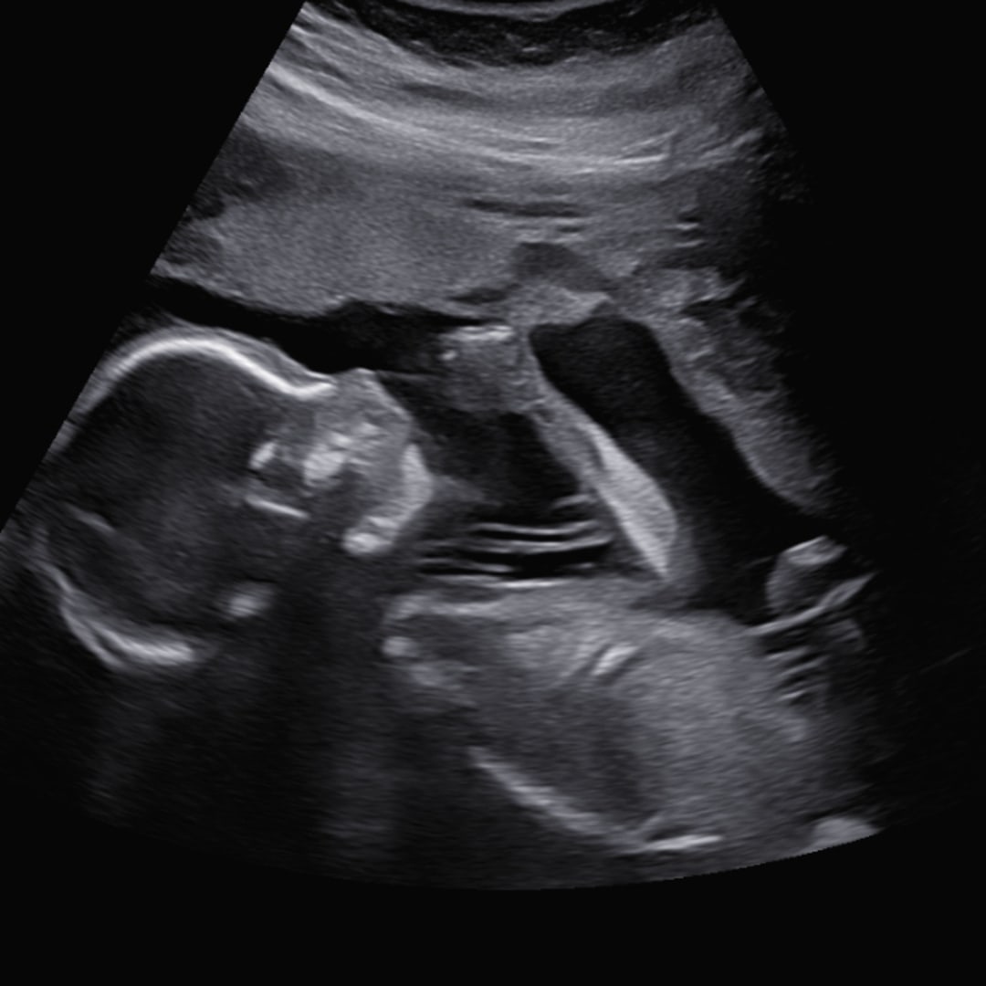 Photo shared by Tina for their Babylist baby registry.