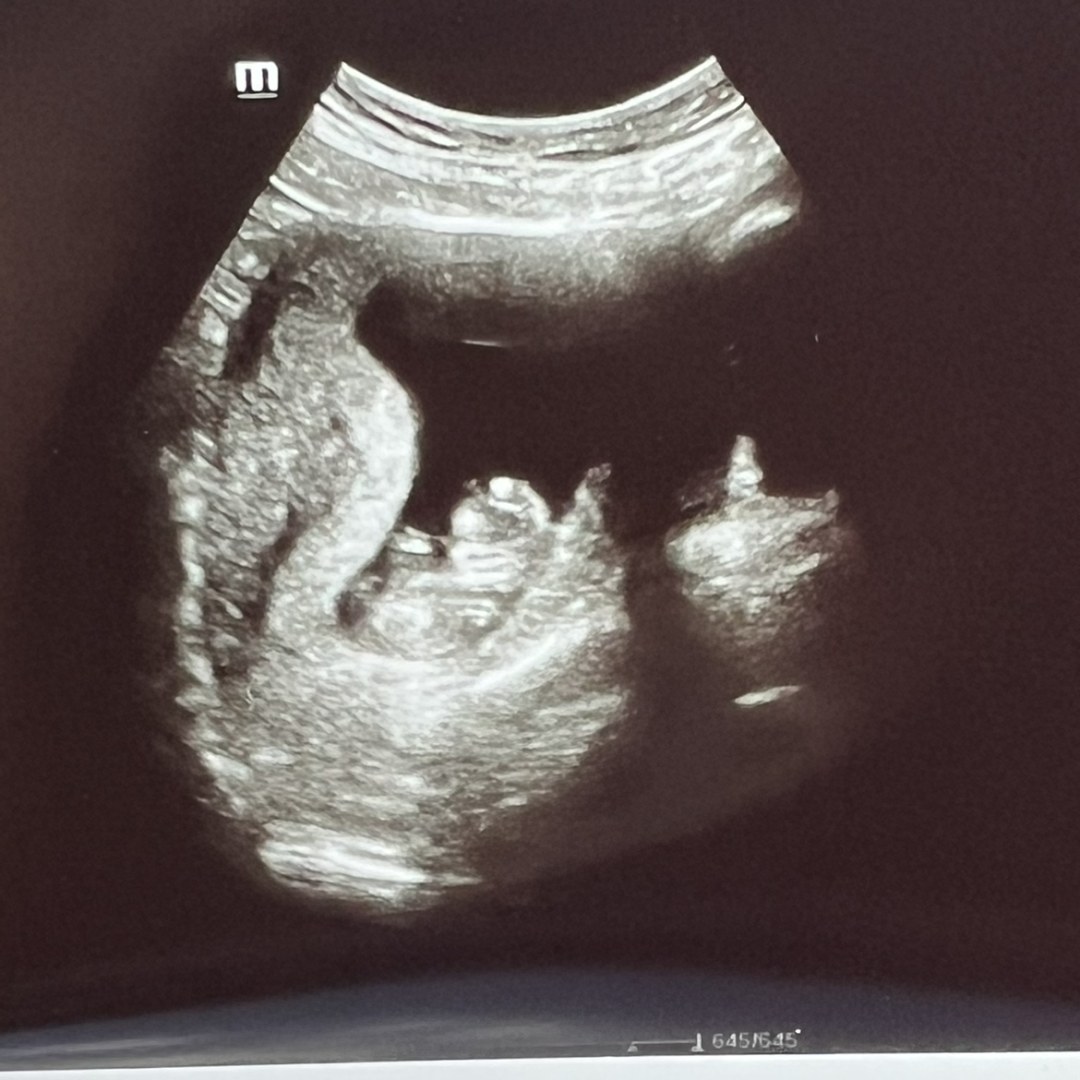 Photo shared by Minji for their Babylist baby registry.