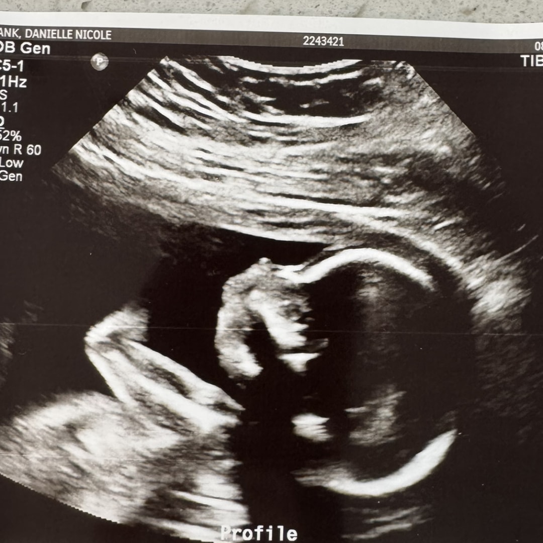 Photo shared by Danielle for their Babylist baby registry.
