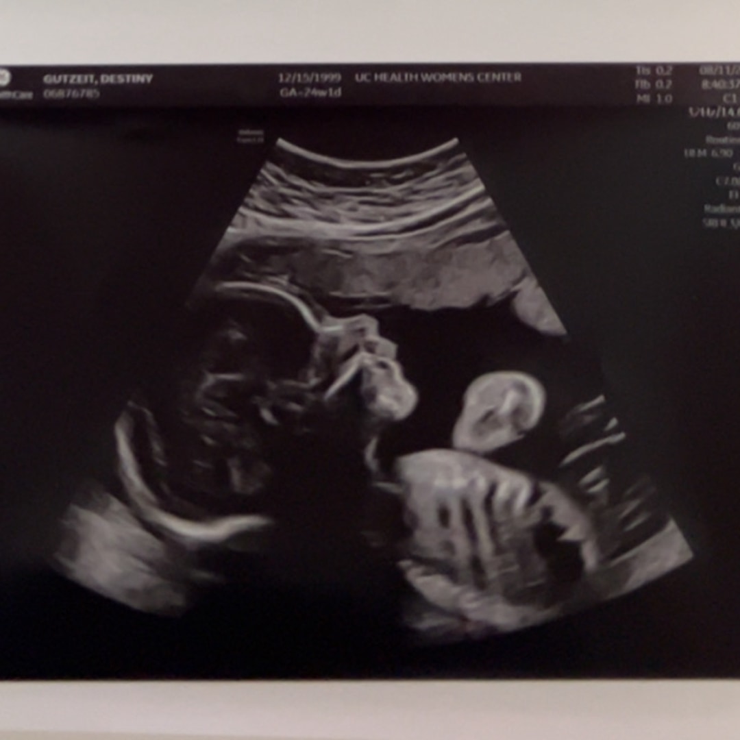 Photo shared by Destiny for their Babylist baby registry.