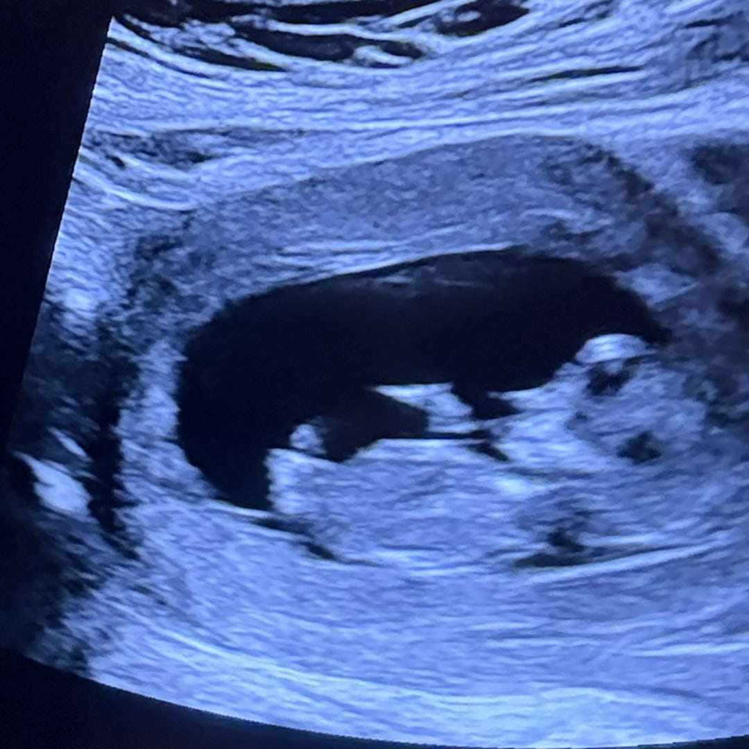 Photo shared by Brooke for their Babylist baby registry.