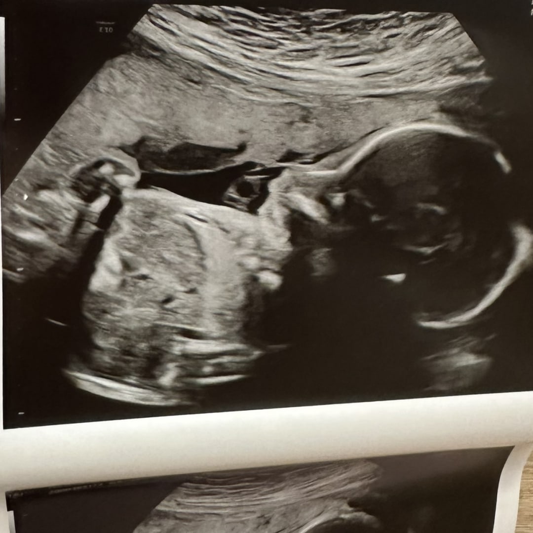 Photo shared by Angelica for their Babylist baby registry.
