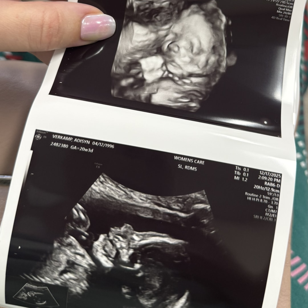 Photo shared by Adisyn for their Babylist baby registry.