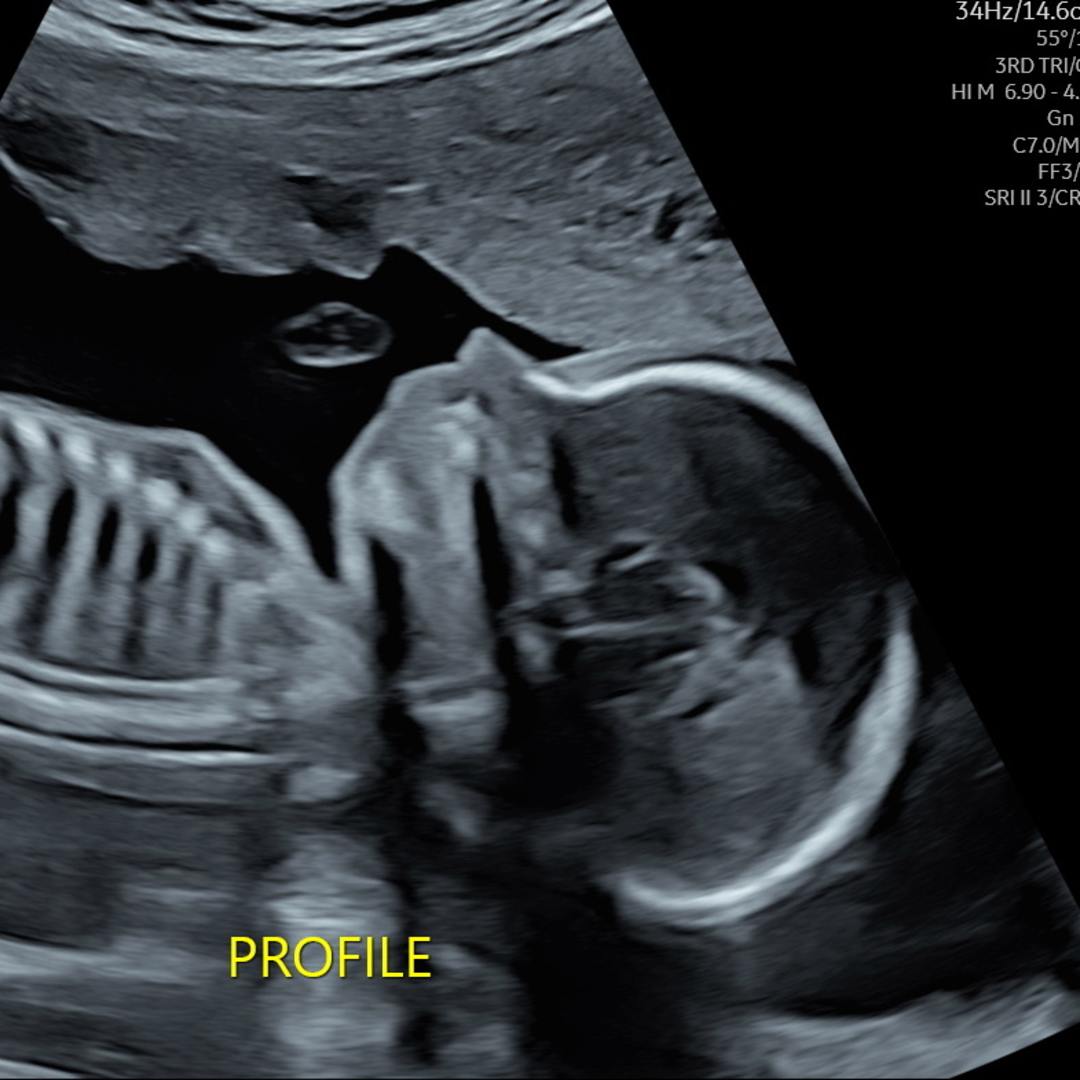 Photo shared by Danielle for their Babylist baby registry.