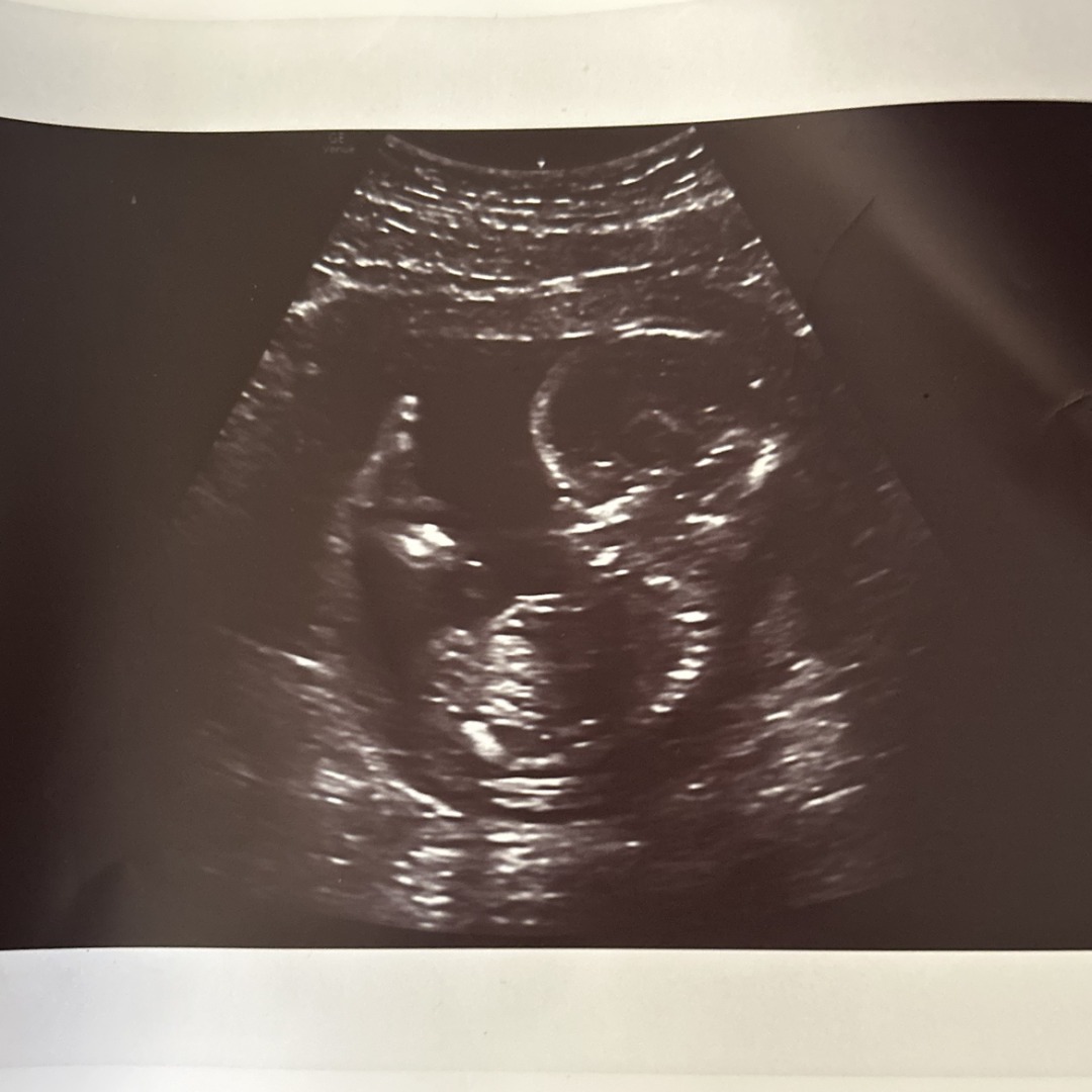 Photo shared by Leilani for their Babylist baby registry.