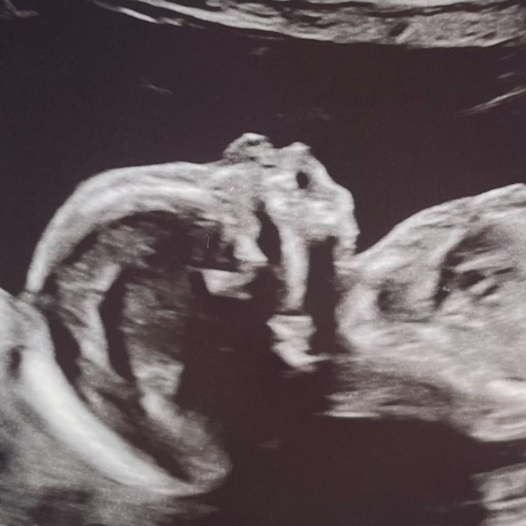 Photo shared by Alexis for their Babylist baby registry.