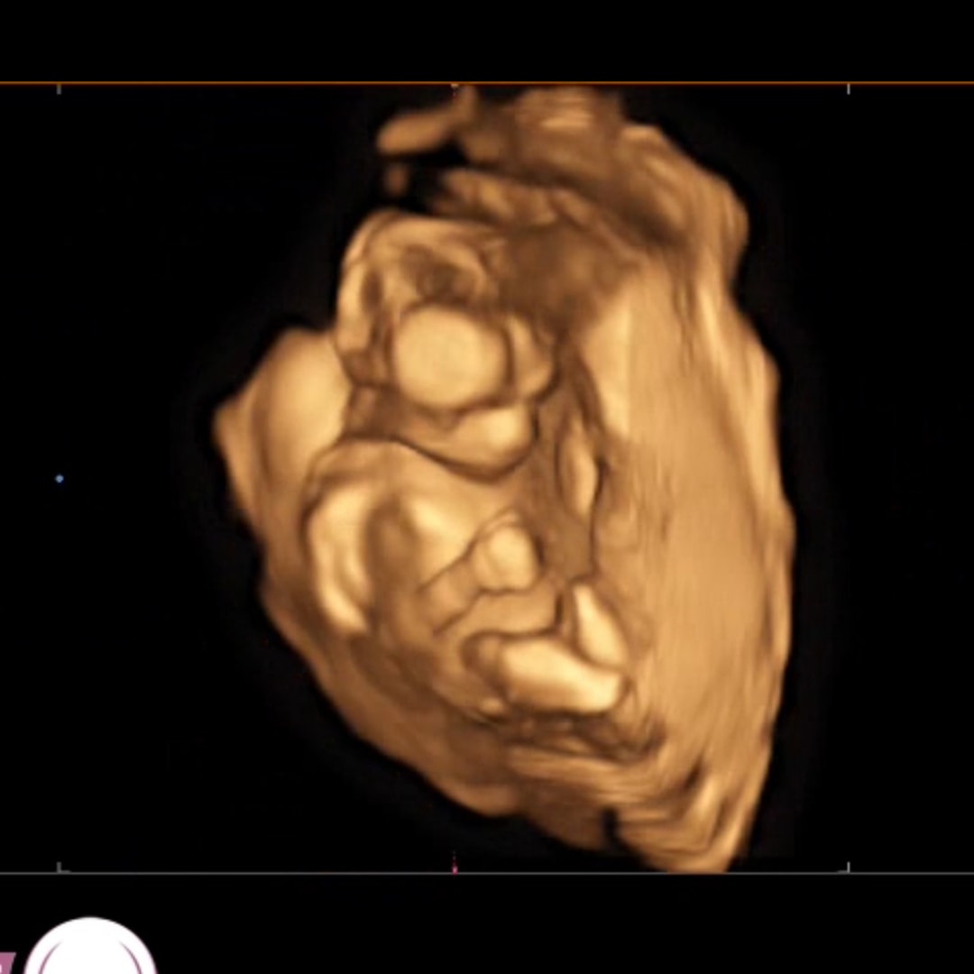 Photo shared by Shelby for their Babylist baby registry.