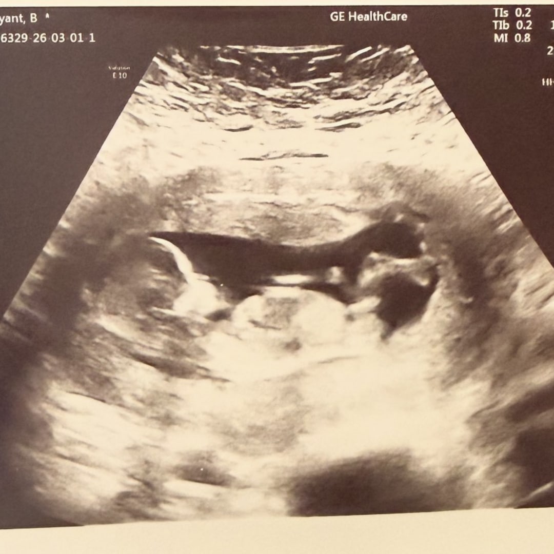 Photo shared by Brytney for their Babylist baby registry.