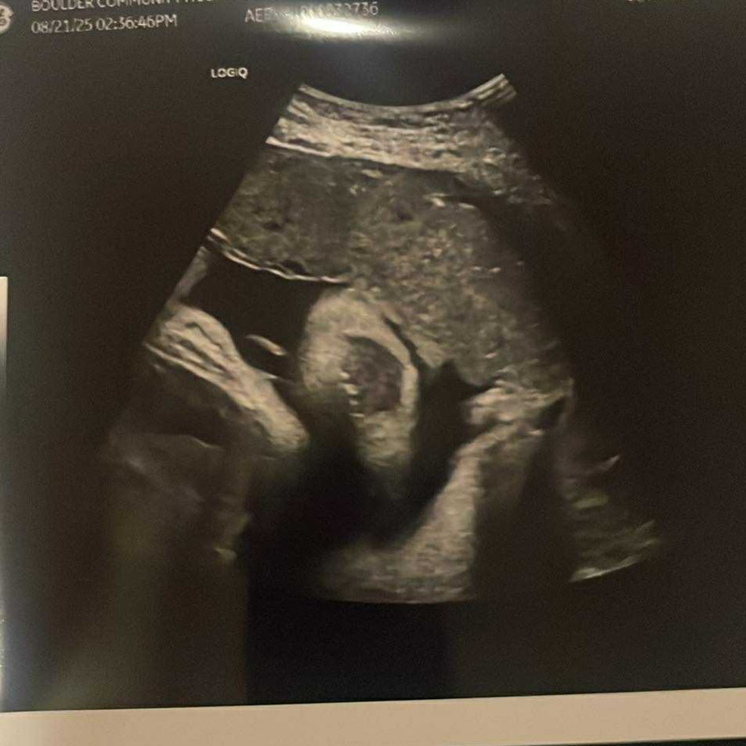 Photo shared by Franchesca for their Babylist baby registry.