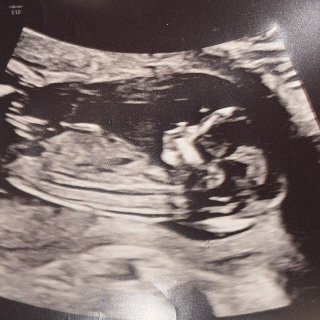 Photo shared by Keishawn for their Babylist baby registry.