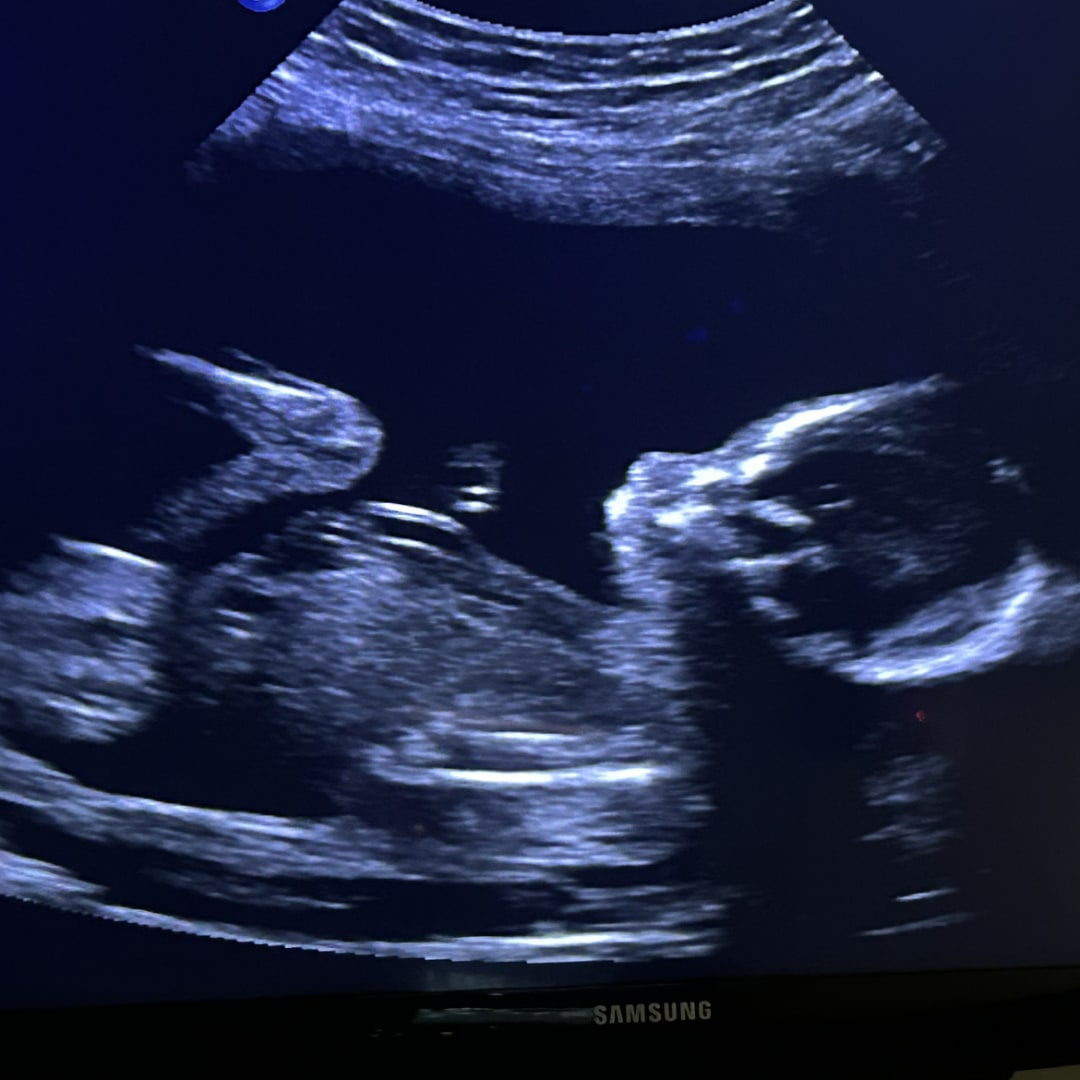 Photo shared by Rachel for their Babylist baby registry.