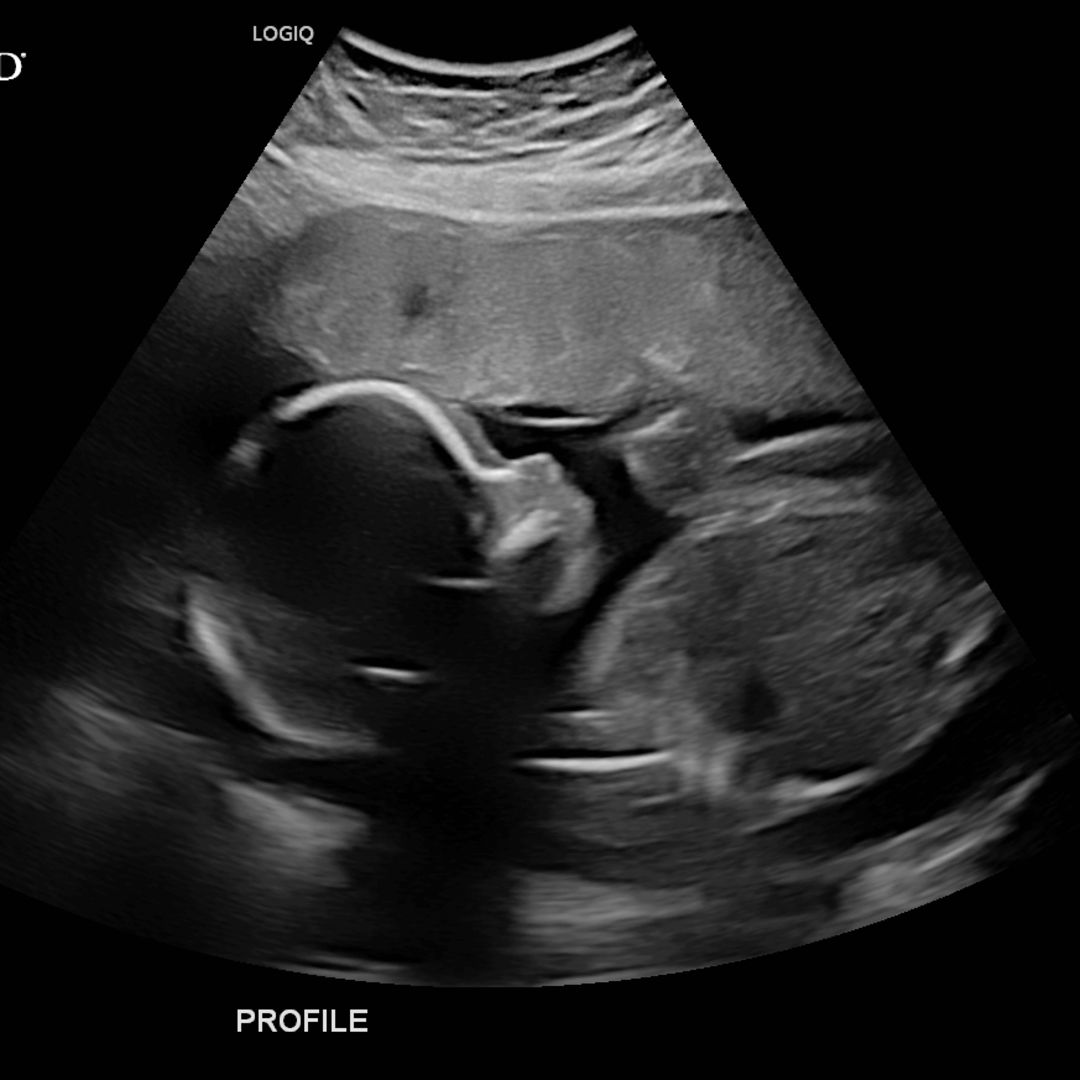 Photo shared by Adair for their Babylist baby registry.