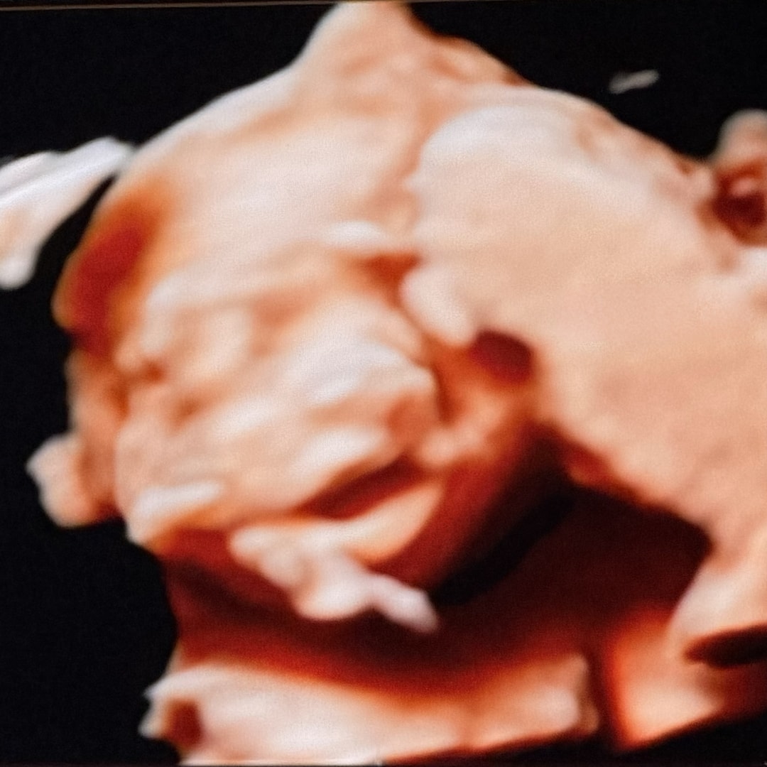 Photo shared by Kara for their Babylist baby registry.