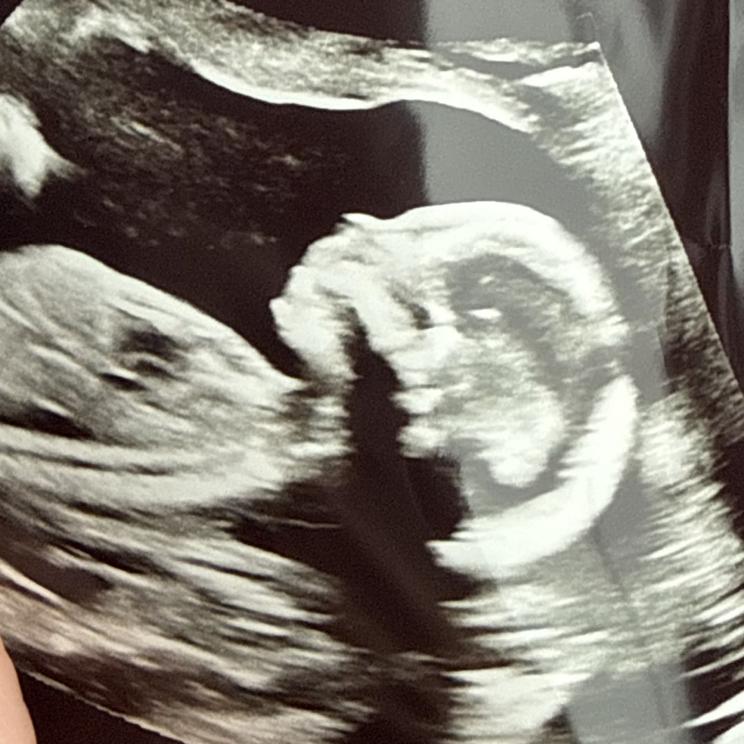 Photo shared by Erica for their Babylist baby registry.