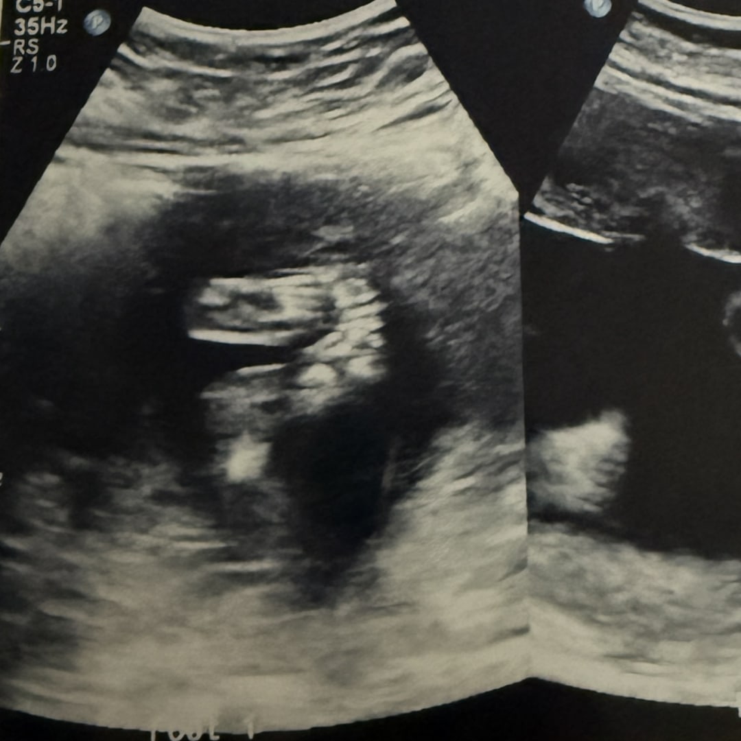Photo shared by Heaven for their Babylist baby registry.
